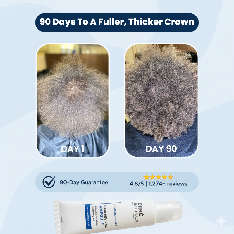 OrréNaturals™ Hair Growth Essentials (2 Ampoules + 1 Serum)