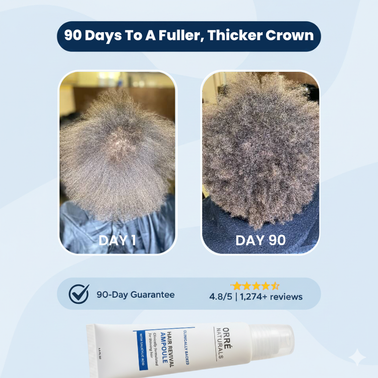 OrréNaturals™ Hair Growth Essentials (2 Ampoules + 1 Serum)